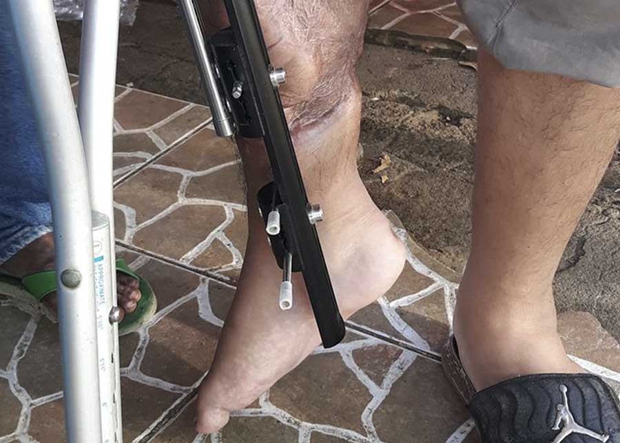 Isaaclesion | Nicaragua Investiga